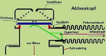 Ablasskopf